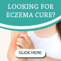 Eczema Fix eBook: Discover The All-Natural Remedies For Eczema Relief!