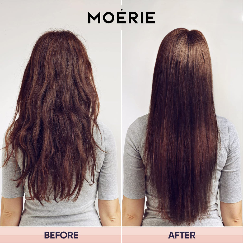 Moerie Shampoo and Conditioner plus Hair Mask and Hair Spray Mega Pack – the Ultimate Hair Growth Care – for Longer, Thicker, Fuller Hair - Volumizing Hair Products – Paraben & Silicone Free - 4 Items